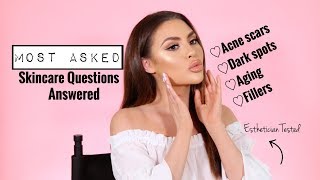 Top Skincare Questions Answered! Acne? Dark Spots? Fillers? Jadeywadey180
