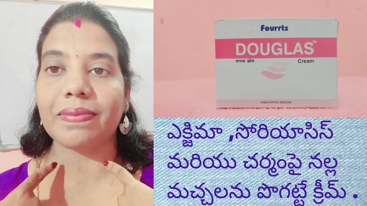 eczema treatment in teluguHow i cured my eczema in 3 days Telugu