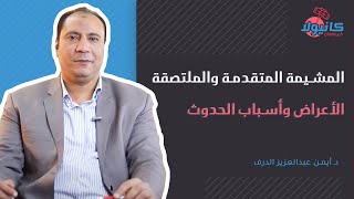 المشيمة المتقدمة والملتصقة - الأعراض وأسباب الحدوث مع د. أيمن عبدالعزيز الدرف | معلومه تهمك