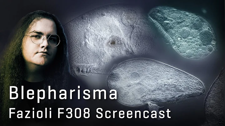 Synchron Fazioli F308: Blepharisma, by D.A. Edwards
