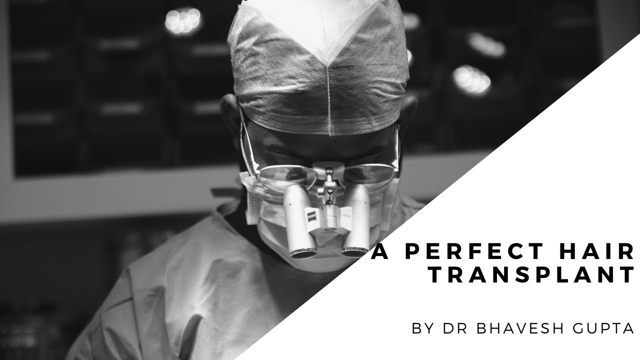 Story of Ashish Razdan's Hair Transplant - YouTube