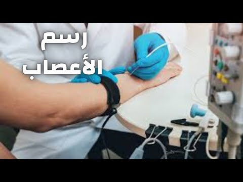 فيديو: ماذا يفعل الرسم التخطيطي؟