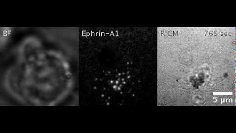 Berkeley Scientists Find New Way to Get Physical in the Fight Against Cancer