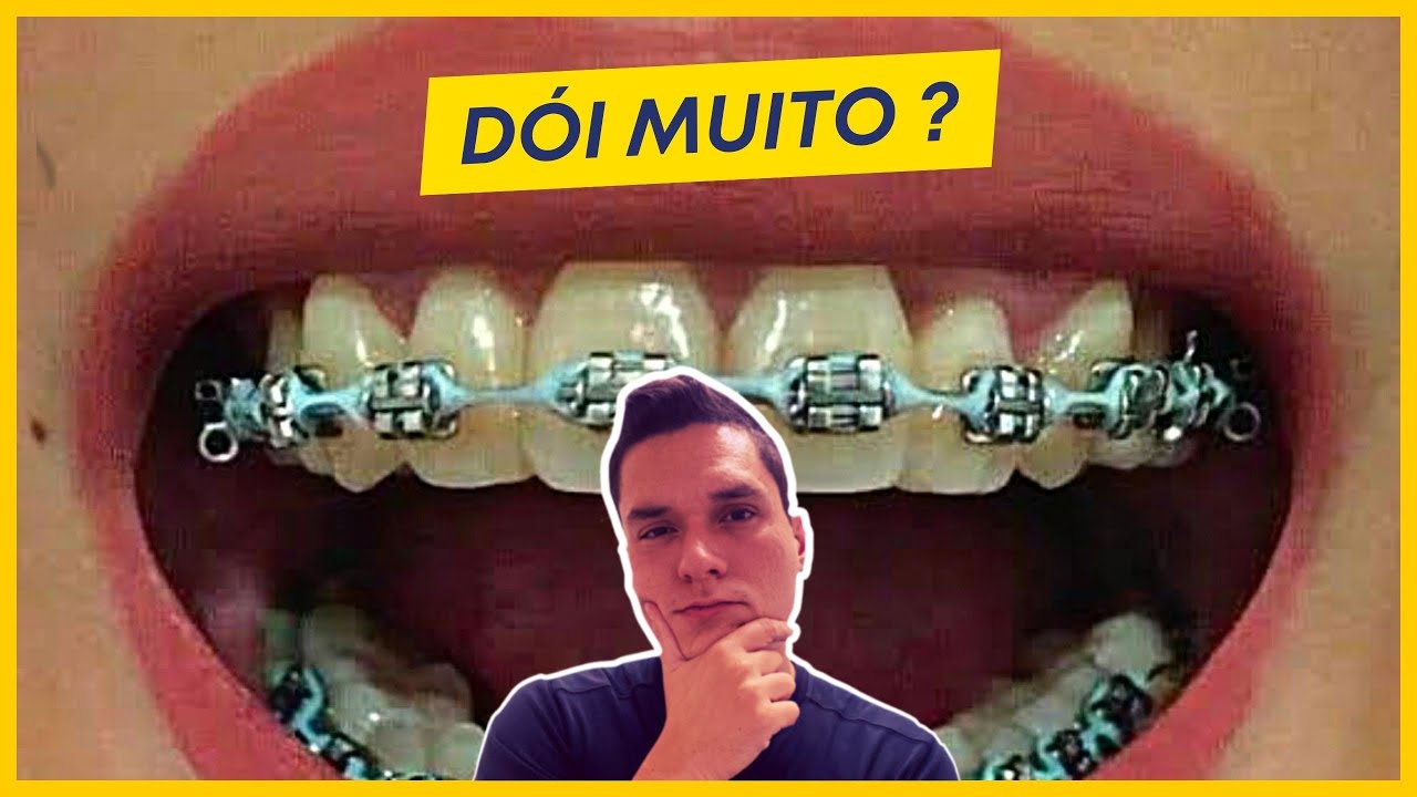 ELÁSTICO EM CORRENTE DÓI MUITO? A VERDADE.