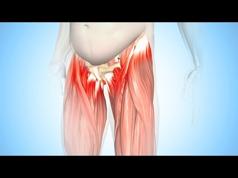 Video: Coxarthrosis - Behandling Af Coxarthrosis Med Folkemedicin Og Metoder