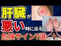 【放置厳禁！】絶対に見逃してはいけない！知らないと損する肝臓が悪い時に現れる症状7選
