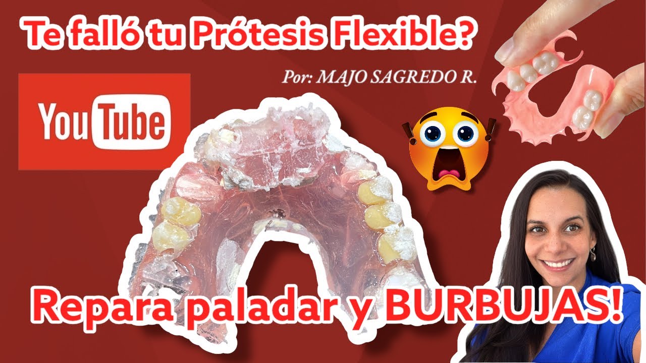 Cómo reparo una prótesis flexible!! Repara un paladar, agrega un diente o ganchos! 😎😎