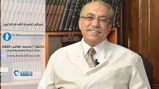 أمراض إصبع القدم الكبير  - أستاذ. دكتور محمد سامى الزهار