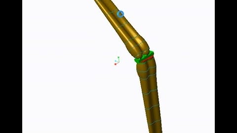Human Knee Joint design, modeling static simulation by PTC Creo ANSYS in biomedical & biomechanics