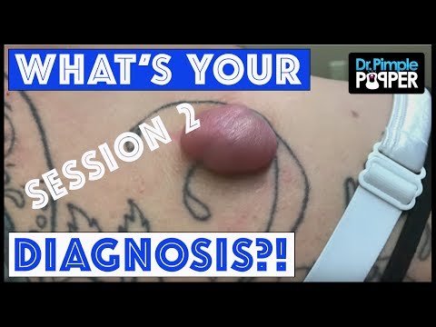 The Finale: What's Your Dr Pimple Popper Diagnosis?