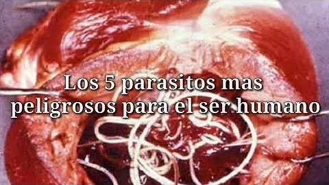 ¿Cuál es el parásito más mortífero para el ser humano?