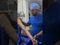 خلع مفصل الكتف وعلاجه