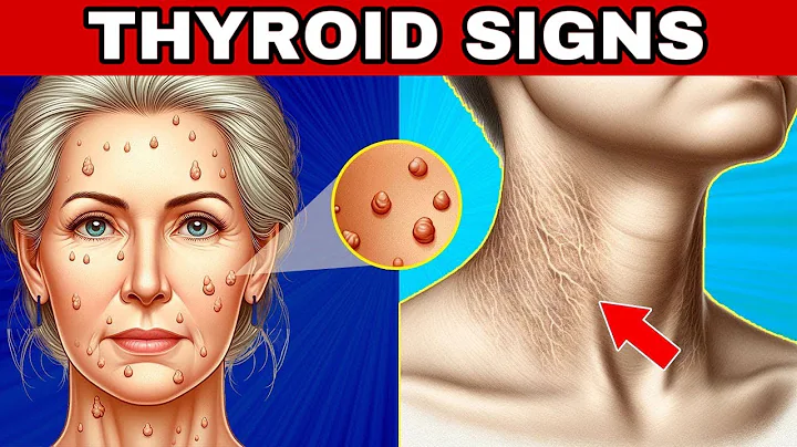 🚨 8 THYROID WARNING SIGNS (Hypothyroidism and Hyperthyroidism)