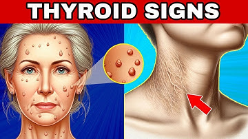🚨 8 THYROID WARNING SIGNS (Hypothyroidism and Hyperthyroidism)