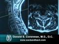 How to Read a MRI of Cervical Nerve Compression | Neck Pain | Colorado Spine Surgeon