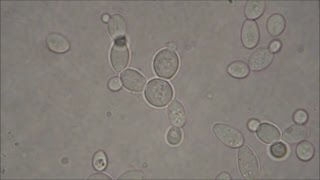 Baker's Yeast under the Microscope