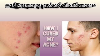 How To Get Rid Of Pimple & Acne in 1 Day| ഒറ്റ രാത്രി മതി മുഖക്കുരു മാറ്റാൻ| 3 ways to remove acne