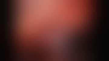 Single Port Retroperitoneal partial nephrectomy