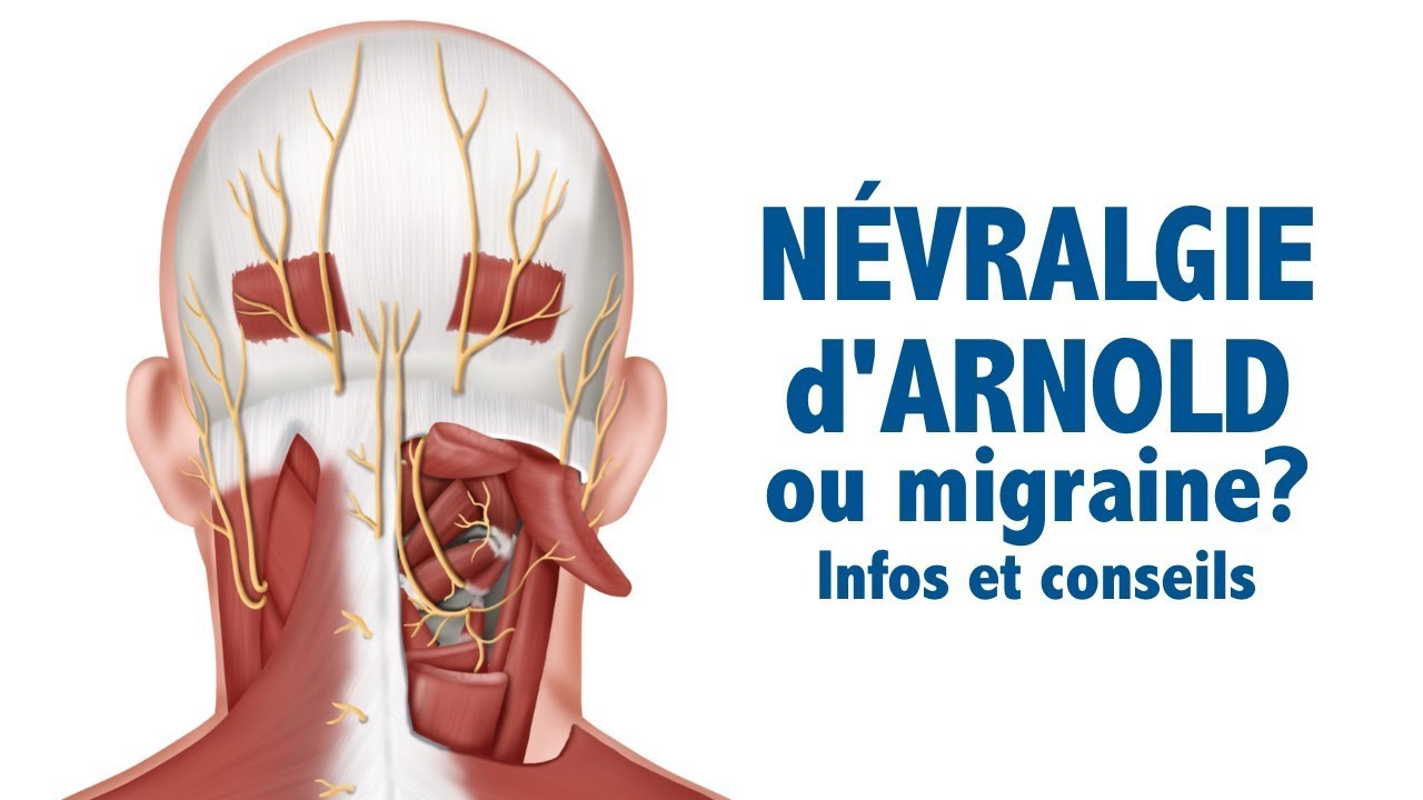 Névralgie d'Arnold ou migraine? Infos et conseils