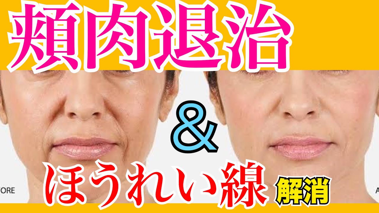 ４分で頬肉を落としてほうれい線を消す方法 国家資格を持つ整体師が教えるセルフケア Youtube