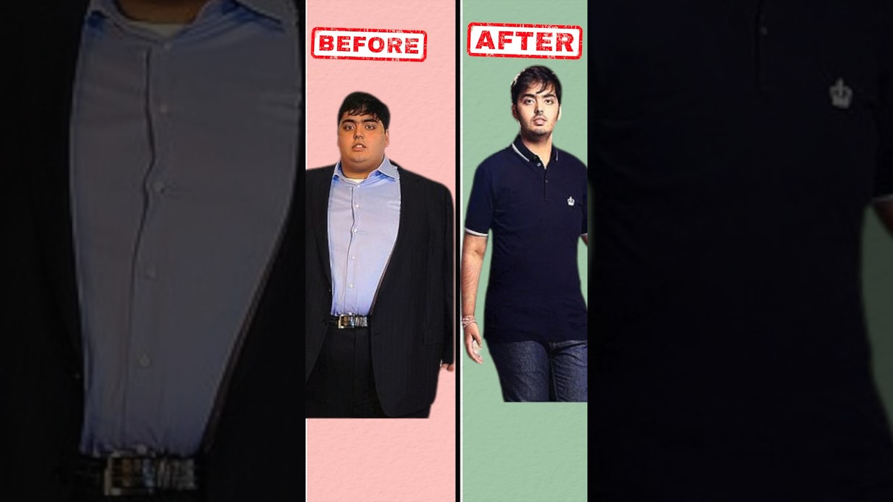 😱Anant Ambani’s Transformation🥵#shorts #transformation #fatloss #anantambani #weightloss