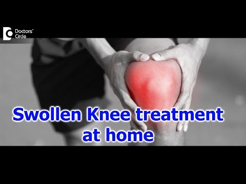 Knee pain and swelling | How to care for a Swollen Knee? - Dr. Mohan M R | Doctors' Circle
