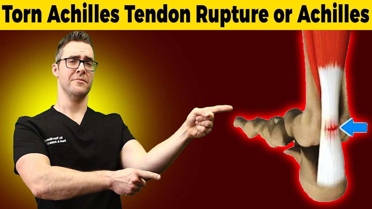 Torn Achilles Tendon Rupture or Achilles Tendonitis? [HOW TO TELL]