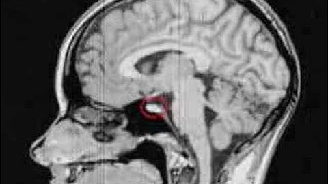 Hypnotic Regression Test 8