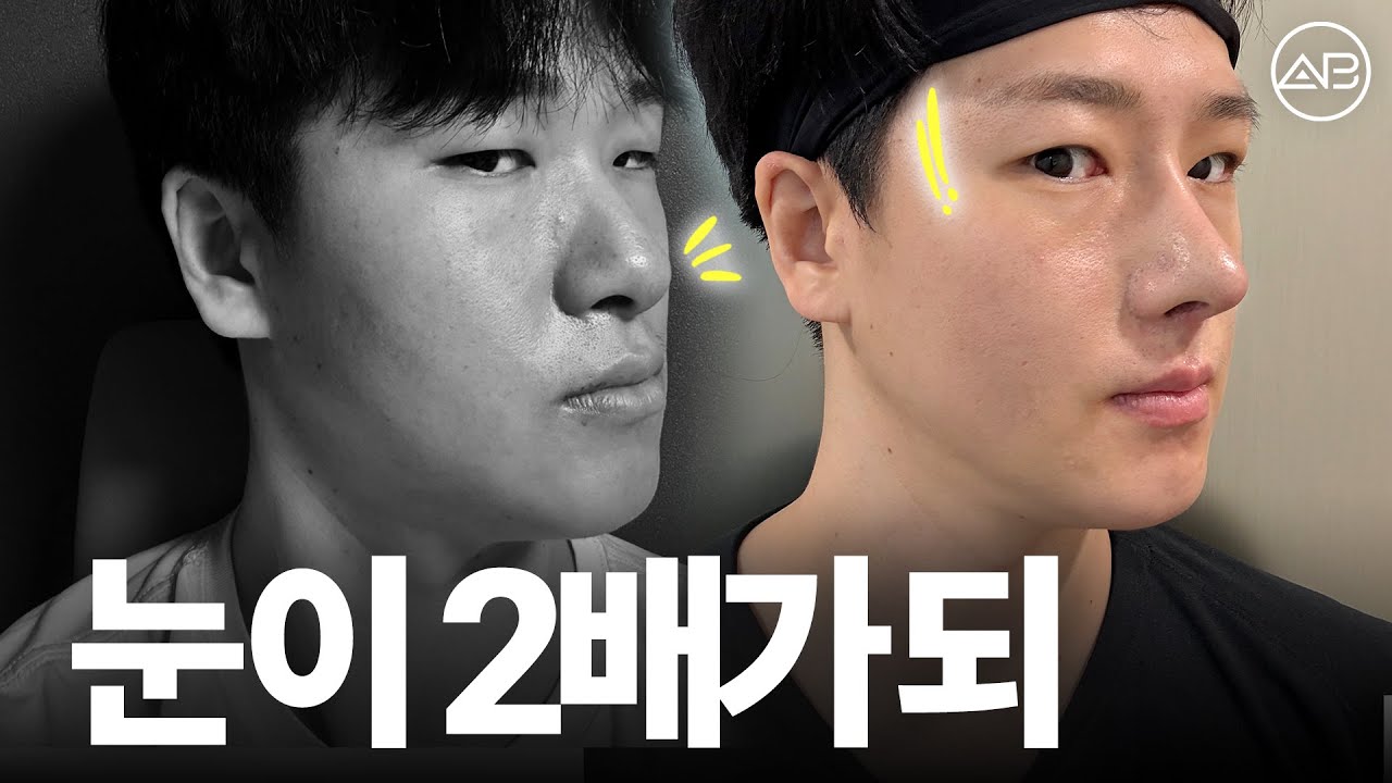 남자도 외모 경쟁력 갖춰야 합니다 | 후기있음 | 에이비성형외과