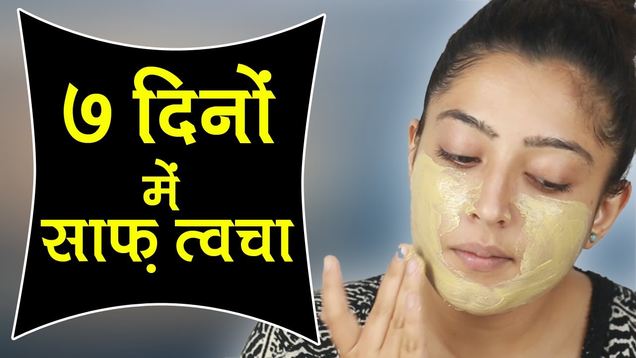 Remove Acne Marks, Scars, Redness in 1 Week - Get Clear Skin in 7 Days ...