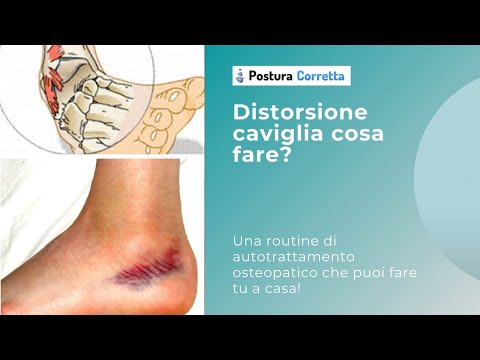 Video: 3 modi per prevenire lesioni alla caviglia