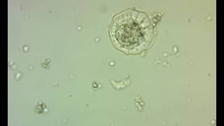 Arcella Testae Amoeba