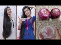 How To Use Onion Juice For Extreme Hairfall/Hair loss/Dandruff | Shanu Priya