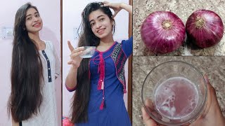 How To Use Onion Juice For Extreme Hairfall/Hair loss/Dandruff | Shanu Priya