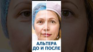 Вместо Альтеры может быть "только 2 Альтеры"? #Альтератерапия #омоложение #косметолог #shorts