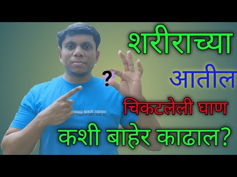 शरीर DETOX करा शरीराच्या आतील चिकटलेली घाण कशी बाहेर काढाल 3Fitness| Marathi Fitness YouTube Channel