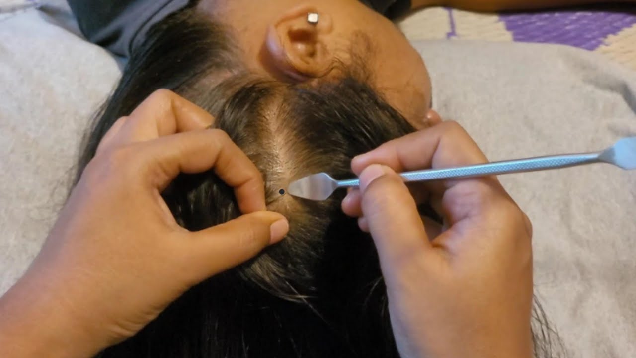 ASMR Scalp Check (INSTANT SLEEP & TINGLES!)