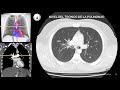 Anatomia Axial del Torax en TC y RM