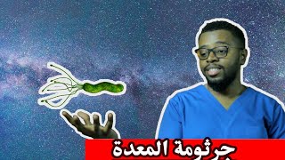 أعراض وعلامات جرثومة المعدة وعلاجها الجذري في المنزل..