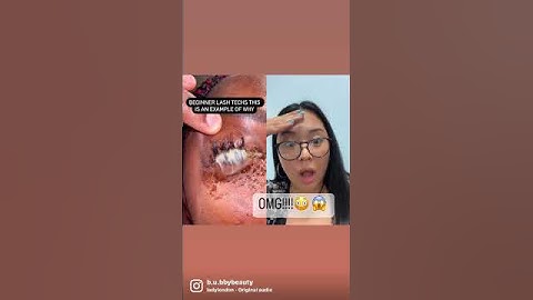 EYE INFECTION FROM LASH EXTENSIONS?!?