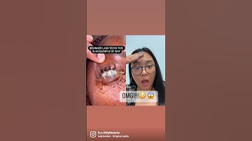 Thumbnail of EYE INFECTION FROM LASH EXTENSIONS?!?