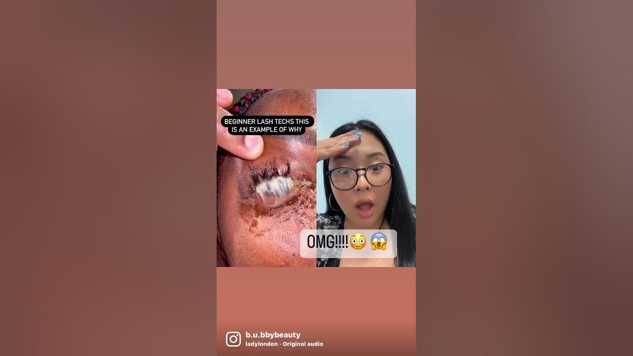 EYE INFECTION FROM LASH EXTENSIONS?!? EYE INFECTION FROM LASH EXTENSIONS?!?