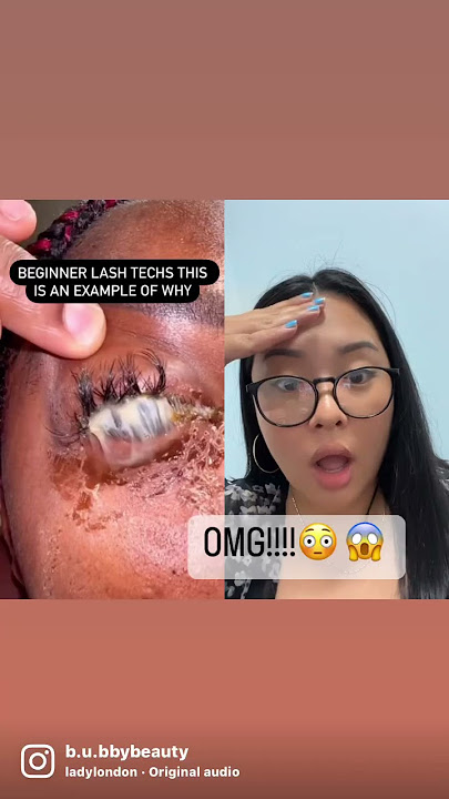 EYE INFECTION FROM LASH EXTENSIONS?!?