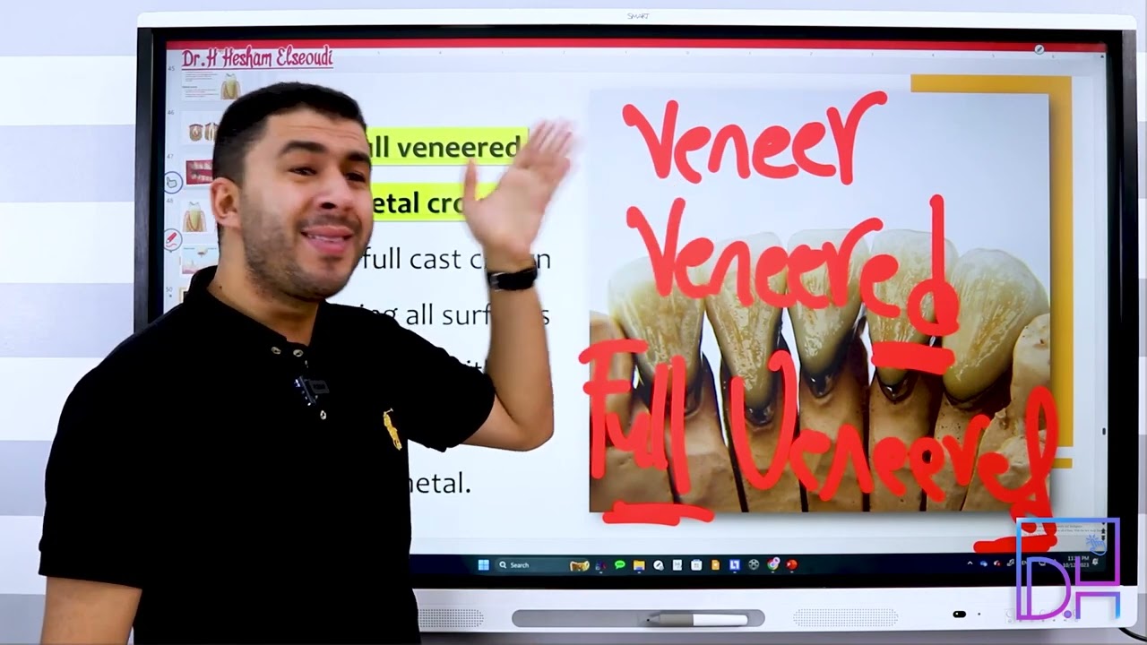 5- Dental Crowns Terminology P2 - مصطلحات هامة بالكراون (التيجان) الجزء الثانى