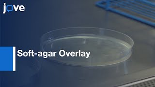 Soft-agar Overlay Screening for Inhibitory Compounds | Protocol Preview screenshot 4