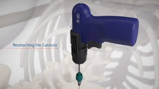 Bd Trek Powered Bone Biopsy System Bone Lesion Procedural Video