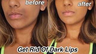 How To Get rid Of Dark Lips And Pigmentation