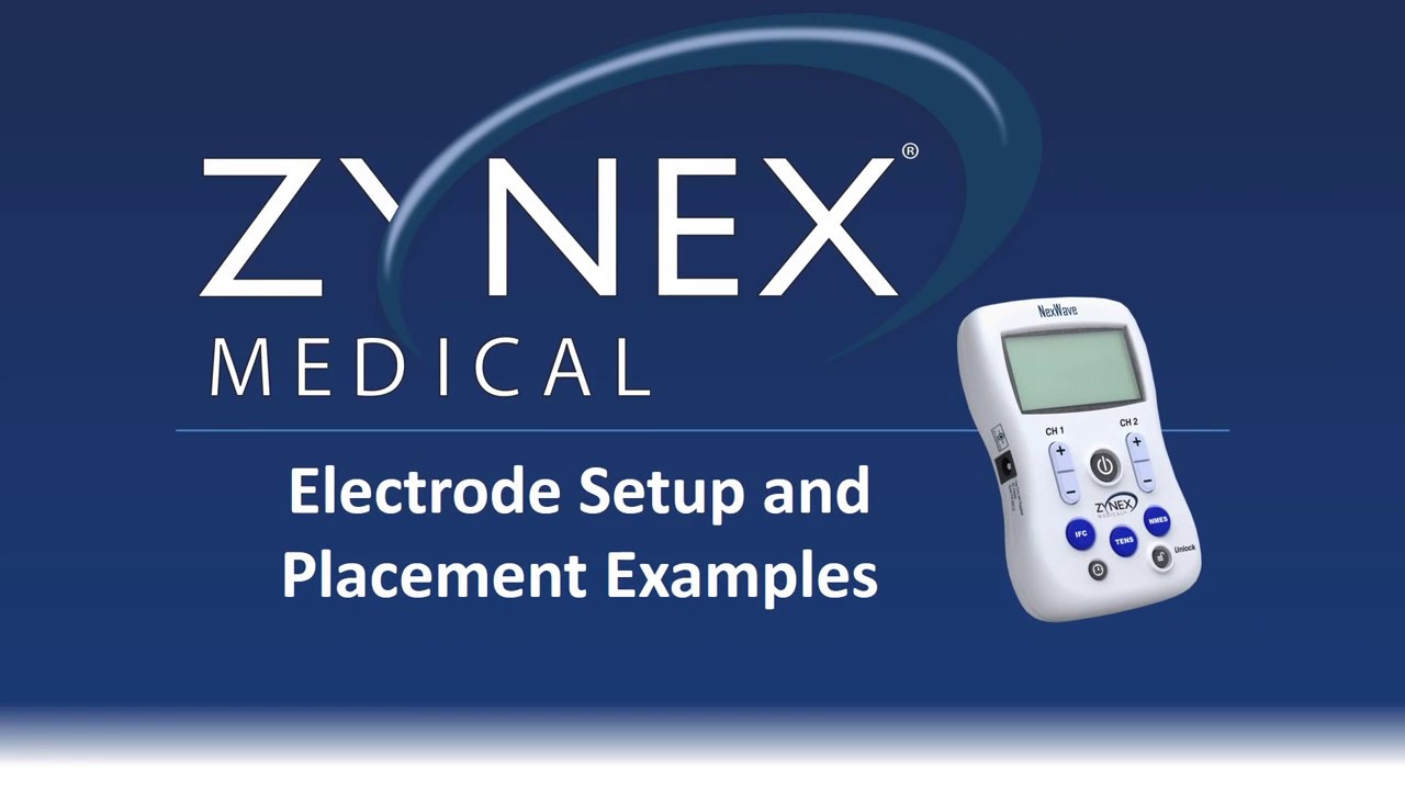 Nmes Electrode Placement Chart