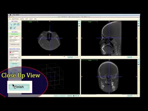 2 Convert DICOM Files to .gipl Files using ITK-SNAP