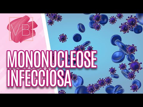 Mononucleose infecciosa: conheça mais sobre a "doença do beijo" - Você Bonita (07/12/2022)